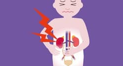 World Kidney Day 2018: chronic kidney disease in India is more common in women than in men