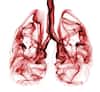 9 dos and don'ts for patients suffering from COPD