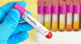 New promise of haemophilia cure