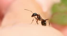 5 tried and tested home remedies for ant bites