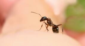 5 tried and tested home remedies for ant bites