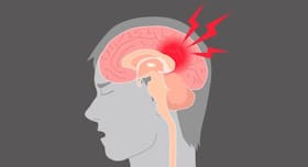 Easier detection of concussions!