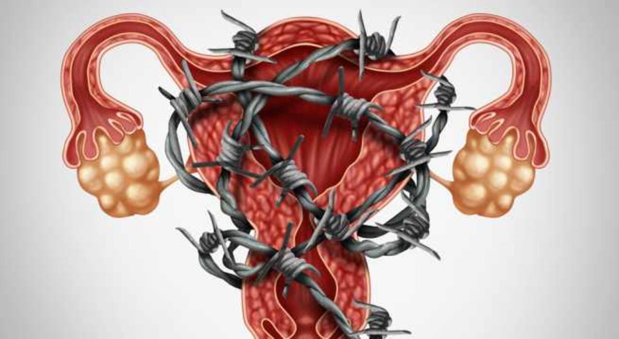 World Homeopathy Awareness Week: Try homeopathy for these 7 diseases that usually need surgery, suggests an expert