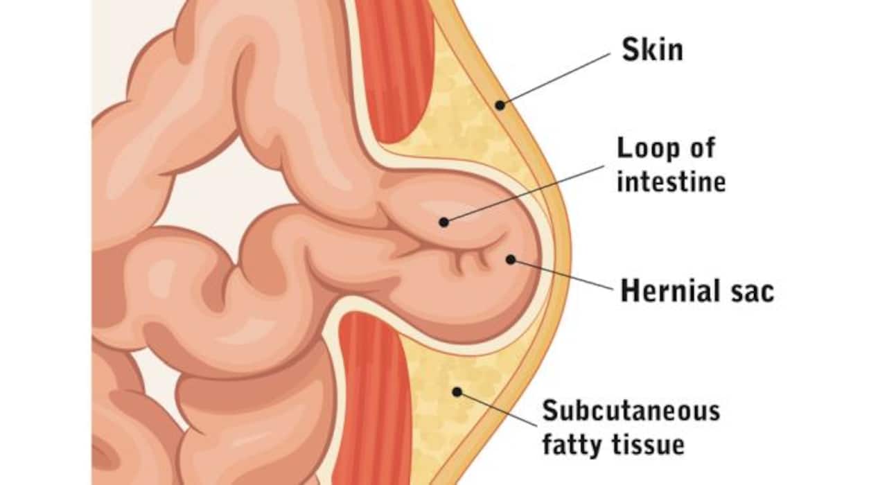 World Homeopathy Awareness Week: Try homeopathy for these 7 diseases that usually need surgery, suggests an expert