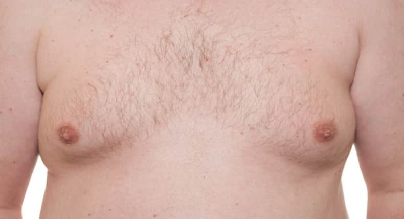 Breast cancer in men -- 7 risk factors every man should know