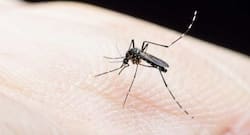 7 home remedies to soothe mosquito bites