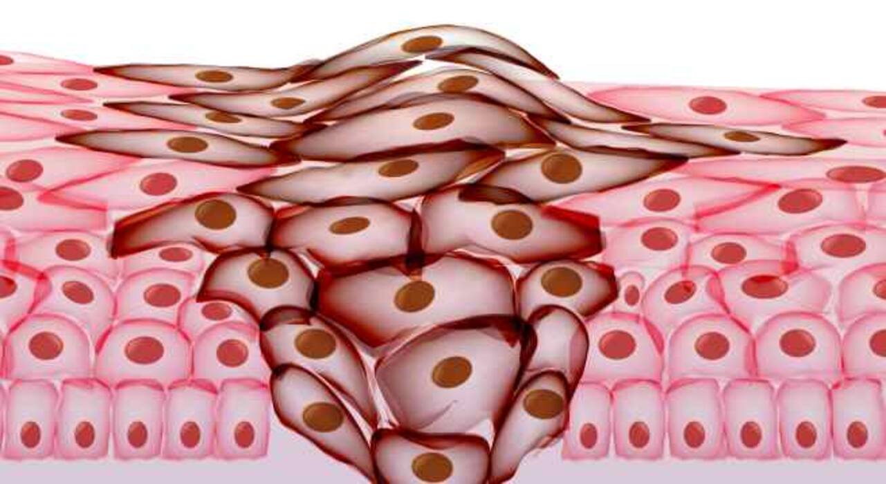 World Homeopathy Awareness Week: Try homeopathy for these 7 diseases that usually need surgery, suggests an expert