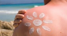 4 reasons you keep getting sunburnt