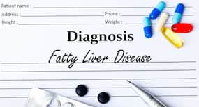 Beware of these 5 signs of non-alcoholic fatty liver disease