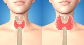 Thyroid cancer: Timely diagnosis and treatment is the key