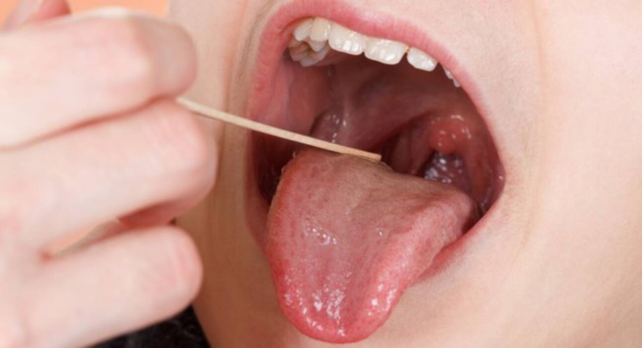 6 surprising things your tongue says about your health