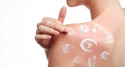 5 shocking things that will make your sunburn even worse!