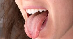 6 surprising things your tongue says about your health