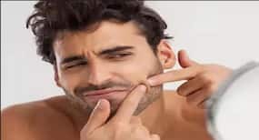 रोजाना यूज होने वाली इन 6 चीजों से भी हो सकते हैं Pimple, Blackhead