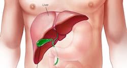 Non-alcoholic fatty liver disease के 5 संकेत