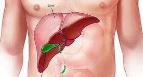 An enzyme can explain connection between fatty liver, diabetes and PCOS