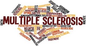 Targeting brain's lymphatic vessels may offer a new way to treat multiple sclerosis, claims study Targeting brain's lymphatic vessels may offer a new way to treat multiple sclerosis, claims study