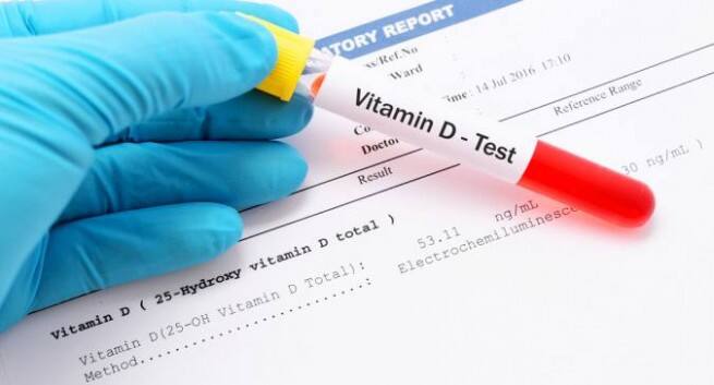 Vitamin D Deficiency Test Everything You Wanted To Know