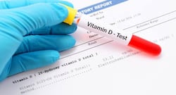 Vitamin D deficiency test -- Everything you wanted to know about this blood test
