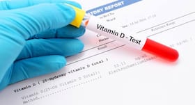Vitamin D deficiency test -- Everything you wanted to know about this blood test