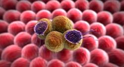 रोजाना Vitamin C का सेवन ब्लड कैंसर को बढ़ने से रोके