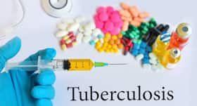 15yr old complaining of conjunctivitis is accurately diagnosed with life-threatening MDR-TB
