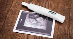 Here's everything you need to know about pregnancy tests