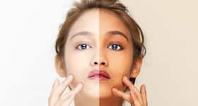 Can sunscreens prevent tanning of skin?
