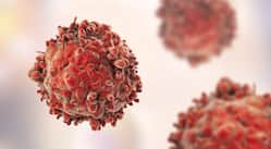 World Blood Cancer Day 2021: Seven Early Signs of Blood Cancer