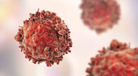World Blood Cancer Day 2021: Seven Early Signs of Blood Cancer