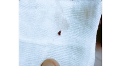 Image of blood clot removed from patient's coronary artery goes viral; has a life lesson that'll make you think
