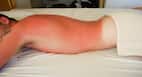 A molecule that darkens skin without UV exposure found; may protect against skin cancer