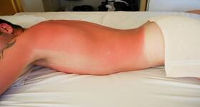 A molecule that darkens skin without UV exposure found; may protect against skin cancer