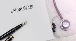 Hepatitis b या जॉन्डिस से राहत पाने के लिए ट्राई करें ये 7 नैचुरल हर्ब