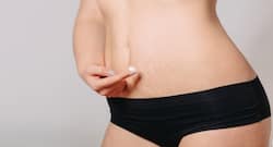 4 Effective Medical Treatments For Stretch Marks