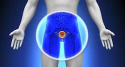 मूत्र मार्ग में संक्रमण (UTI) से जुड़ी ये 5 बातें हर पुरुष को जानना है जरूरी