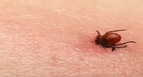 Lone Star Tick bites can make you allergic to meat!