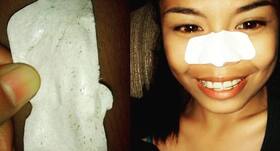 Would you use pore strips to remove blackheads?