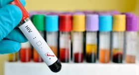 HIV - new experimental vaccine design shows hope