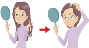 बारिश में बाल झड़ते हैं? तो खाएं ये 5 हेल्दी चीज़ें! बारिश में बाल झड़ते हैं? तो खाएं ये 5 हेल्दी चीज़ें!