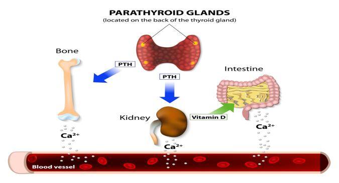 Hyperparathyroidism: What happens if you have high PTH levels? - Read ...