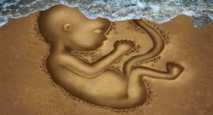 What are the causes of recurrent miscarriages? What are the causes of recurrent miscarriages?