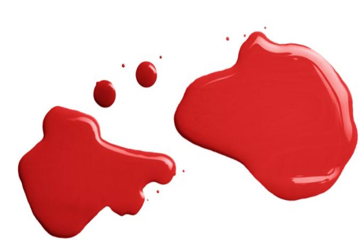 Get Wallpaper Bleeding Before Period In Hindi لم يسبق له مثيل الصور Tier3 Xyz Free HD