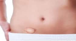 Hernia: When To See A Doctor?