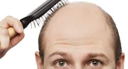 What is 'No Root Touch' surgical hair transplant and restoration?