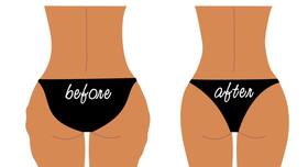 How to lose weight without getting stretch marks How to lose weight without getting stretch marks