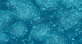 Scientific breakthrough: Scientists grow sheep embryos containing human cells