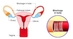 What are blocked tubes and what are its causes?