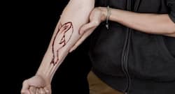 Blue Whale game: Fortis launches 24x7 helpline