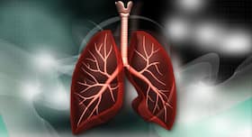 Is it possible to get a lung transplant? Is it possible to get a lung transplant?